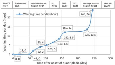 Perioperative Bilateral Medial Medullary Infarction With “Snake Eyes Appearance”: A Case Report